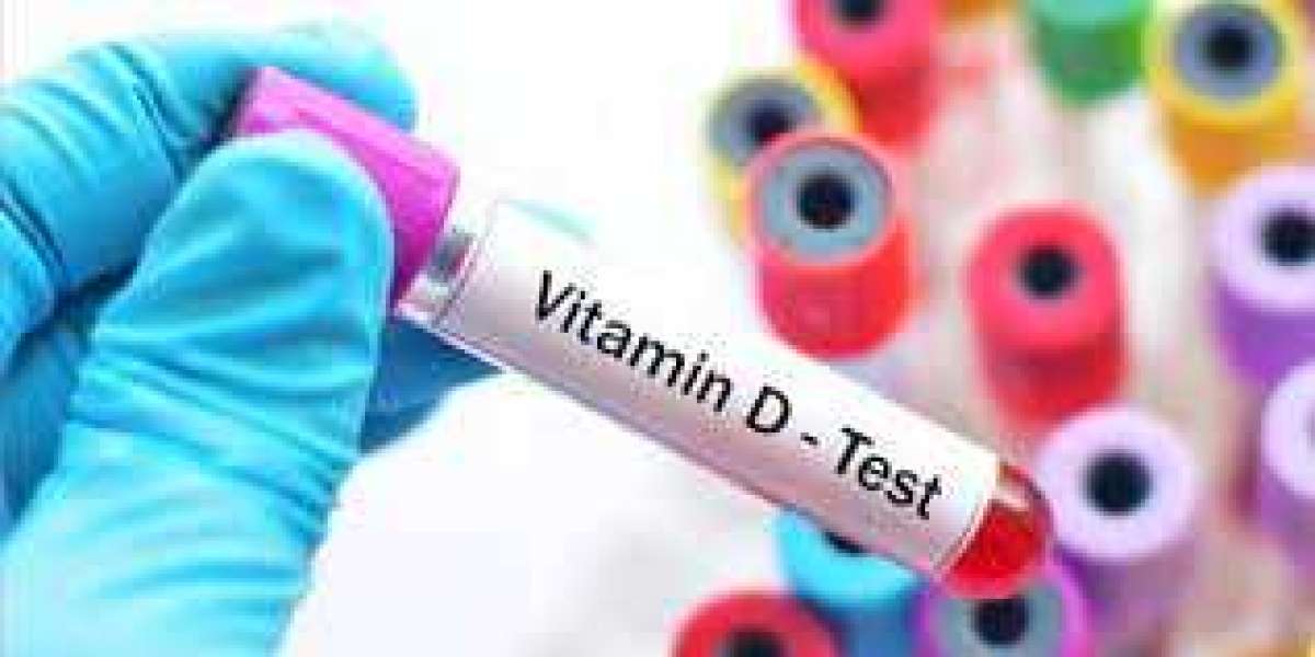 Vitamin D Testing Market Soars $784.65 Billion by 2030