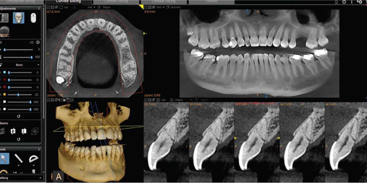 CBCT Dental Imaging Market Players Share is Expected to Witness Higher Growth
