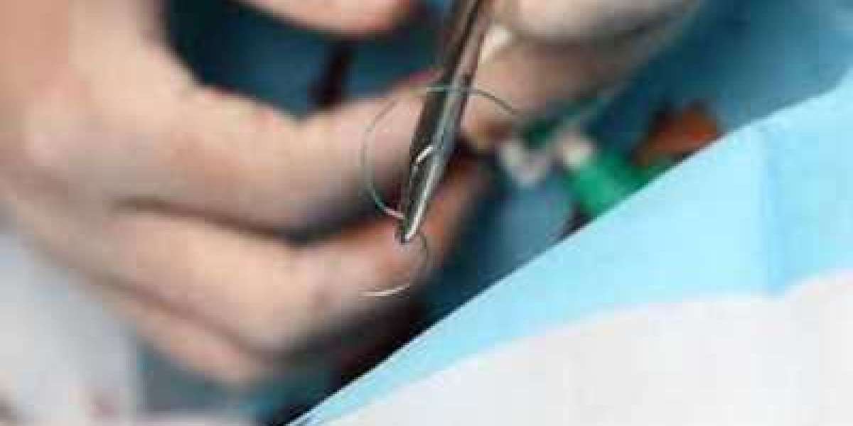 Surgical Stitching Products Market Soars $6.13 Billion by 2030