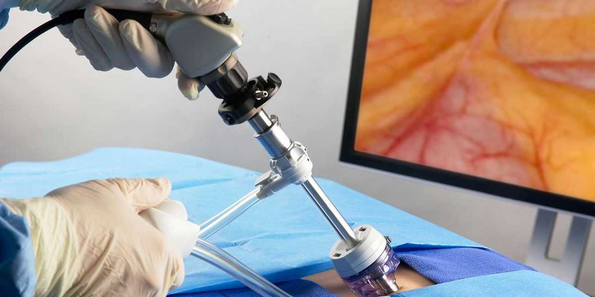 Handheld Surgical Devices Market Players Share is Projected to Grow Vigorously During the Forecast Period