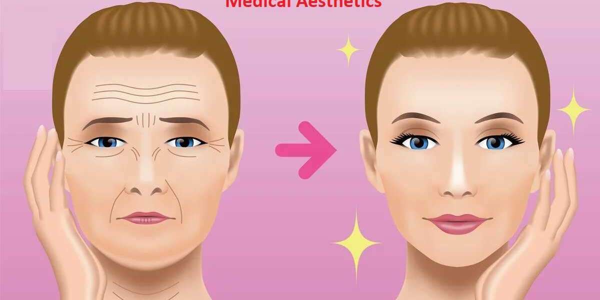 Medical Aesthetics Market Players Share Report with Revenue Growth & Top Strategies