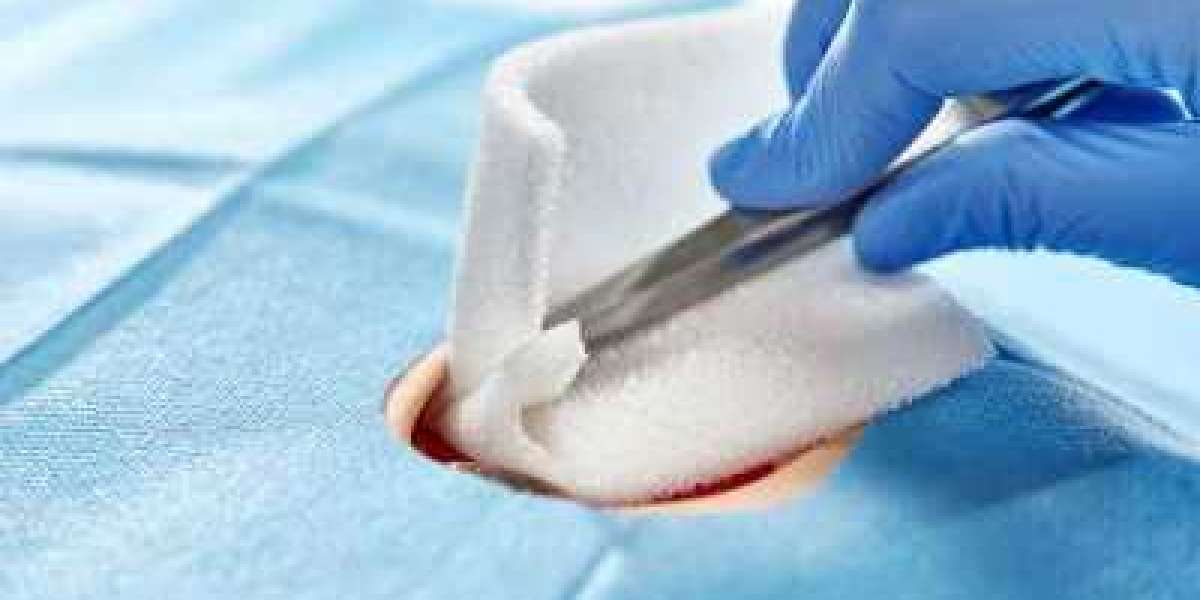 Medical Non-Woven Disposables Market Size $23260.95 Million by 2030