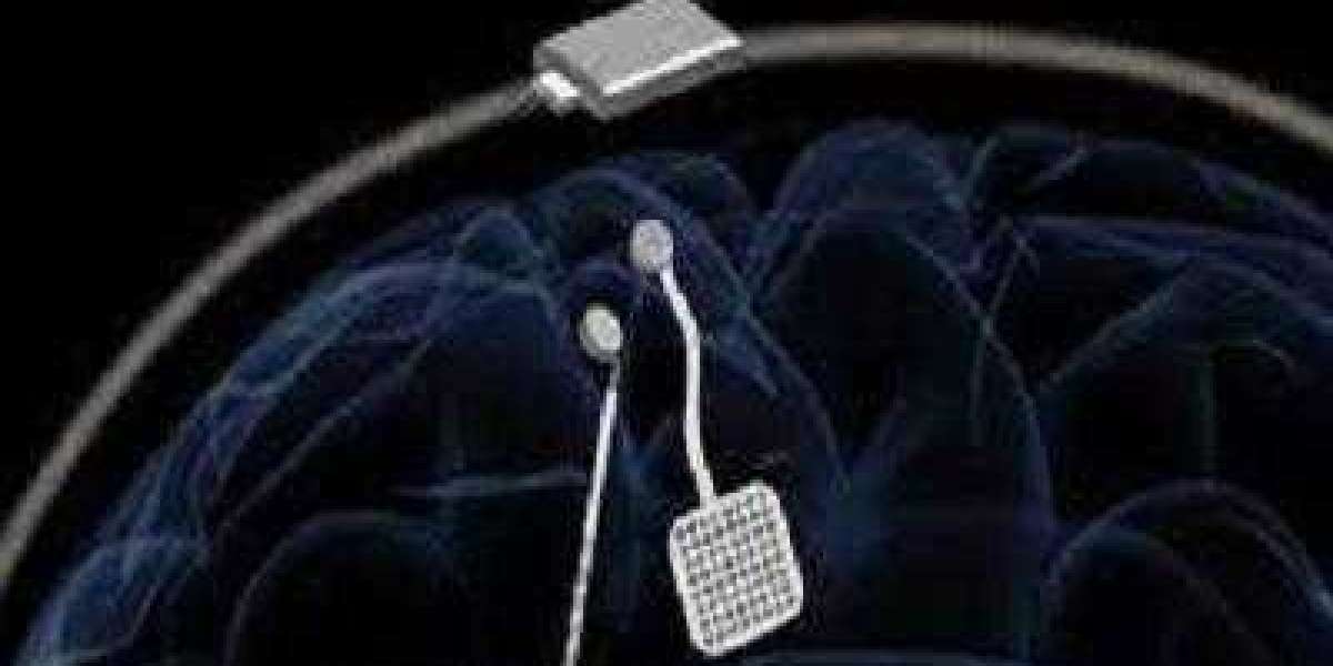 Brain Pacemaker Market Size $3.52 Billion by 2030