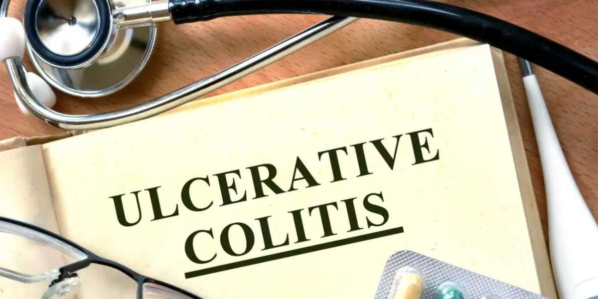 Ulcerative Colitis Market Size, Share, Growth Drivers, Opportunities, Trends, Overall Sales and Demand Forecast To 2030