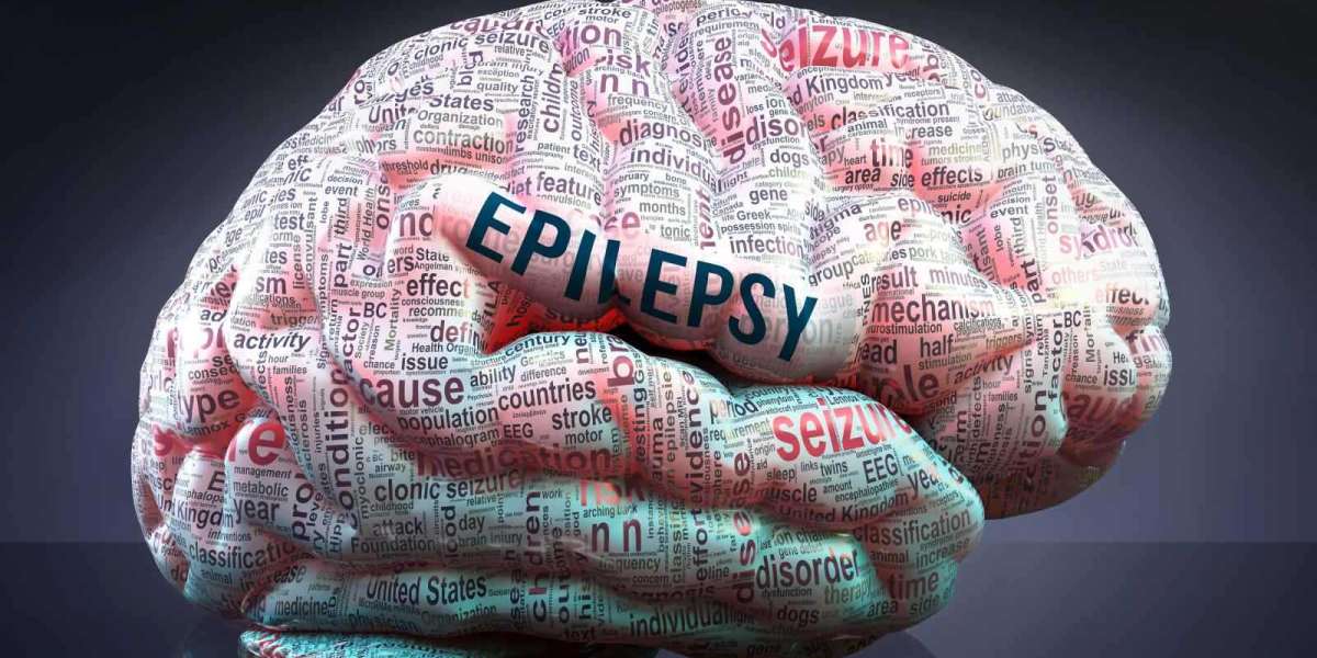 An In-Depth Exploration of Epilepsy: Gaining Insight into the Brain's Seizures