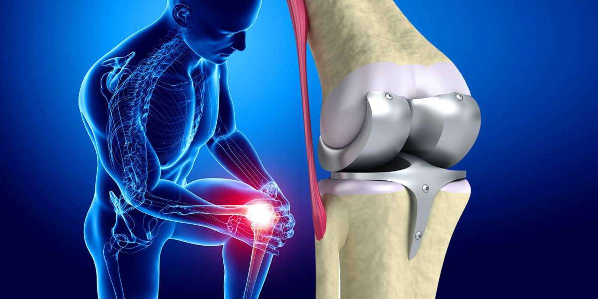 Faster Recovery, Less Pain: The Minimally Invasive Revolution in Knee Replacement
