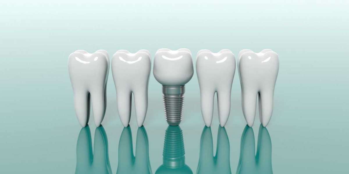 Dental Materials Market Booms at 8.5% CAGR: Biomimetic Teeth & Regeneration Drive Growth