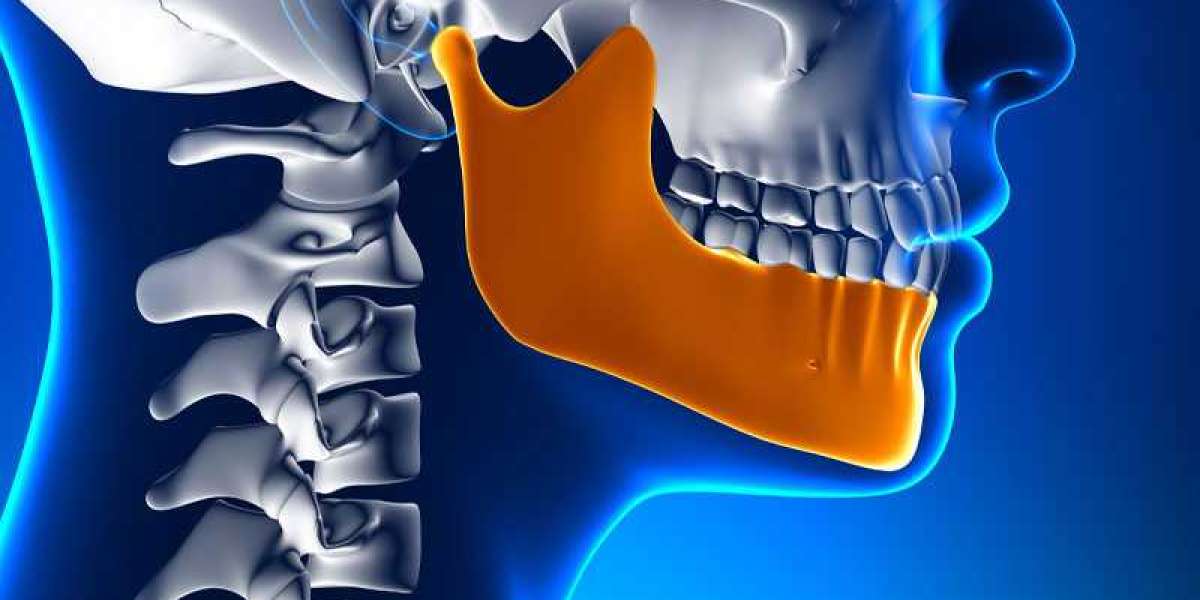Jaw Pain Relief on the Horizon: TMJ Implants Market Set for Steady Growth at 4.22% CAGR