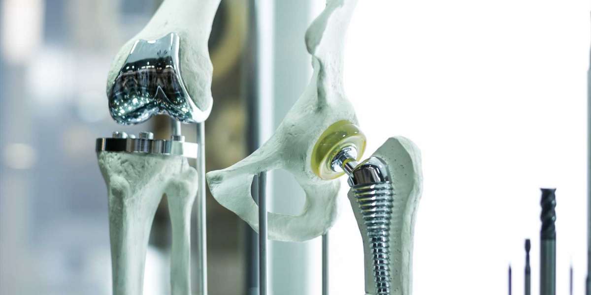 Booming in the Americas: Orthopedic Biomaterial Market Gears Up for Growth