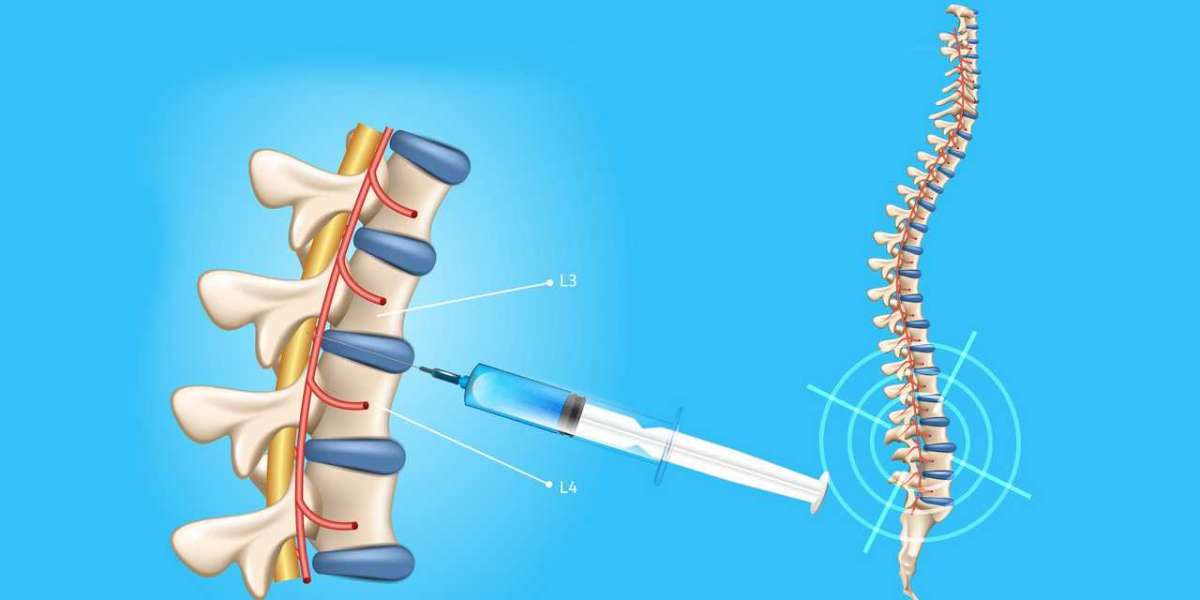 Targeted Relief: Spinal Needles Market Poised for Growth in Pain Management