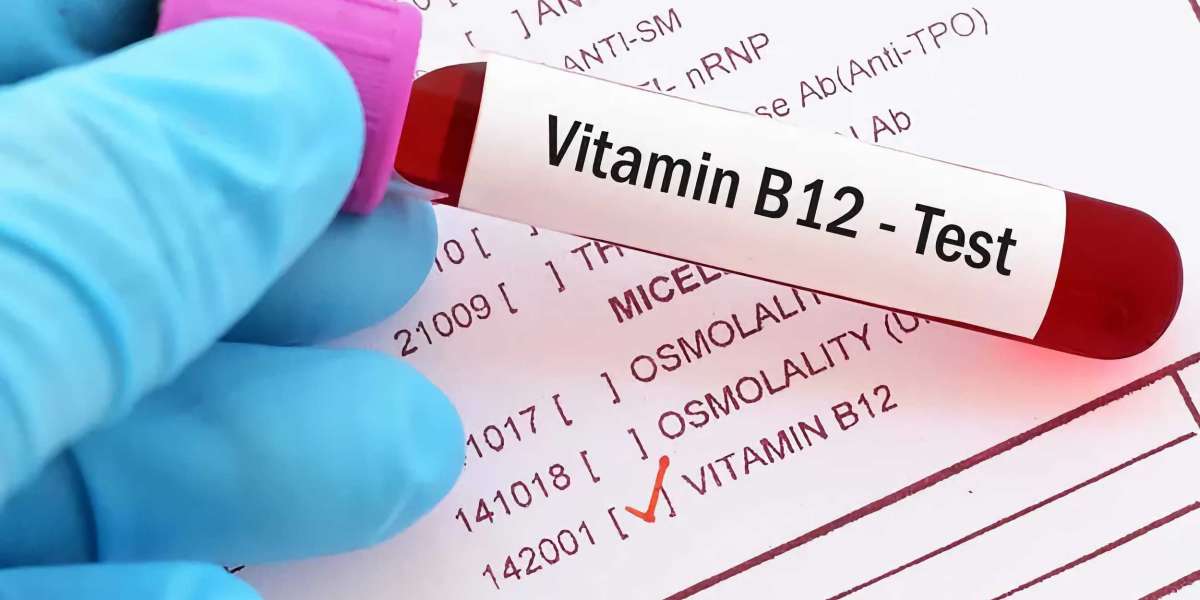 Beyond B12 Basics: The Active B12 Test for Accurate Vitamin Assessment