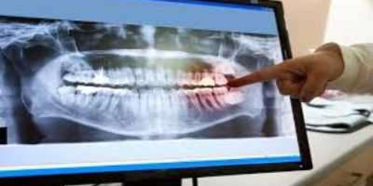 Dental Imaging Market Worth $4.23 Billion by 2032