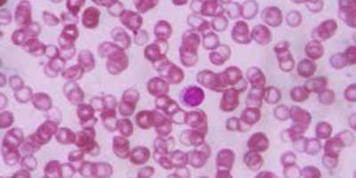 Sickle Cell Disease Diagnosis Market Worth $4.31 Billion by 2032