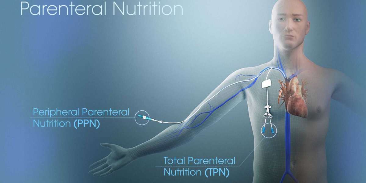 Parenteral Nutrition Market Key Details and Outlook by Top Companies Till 2030