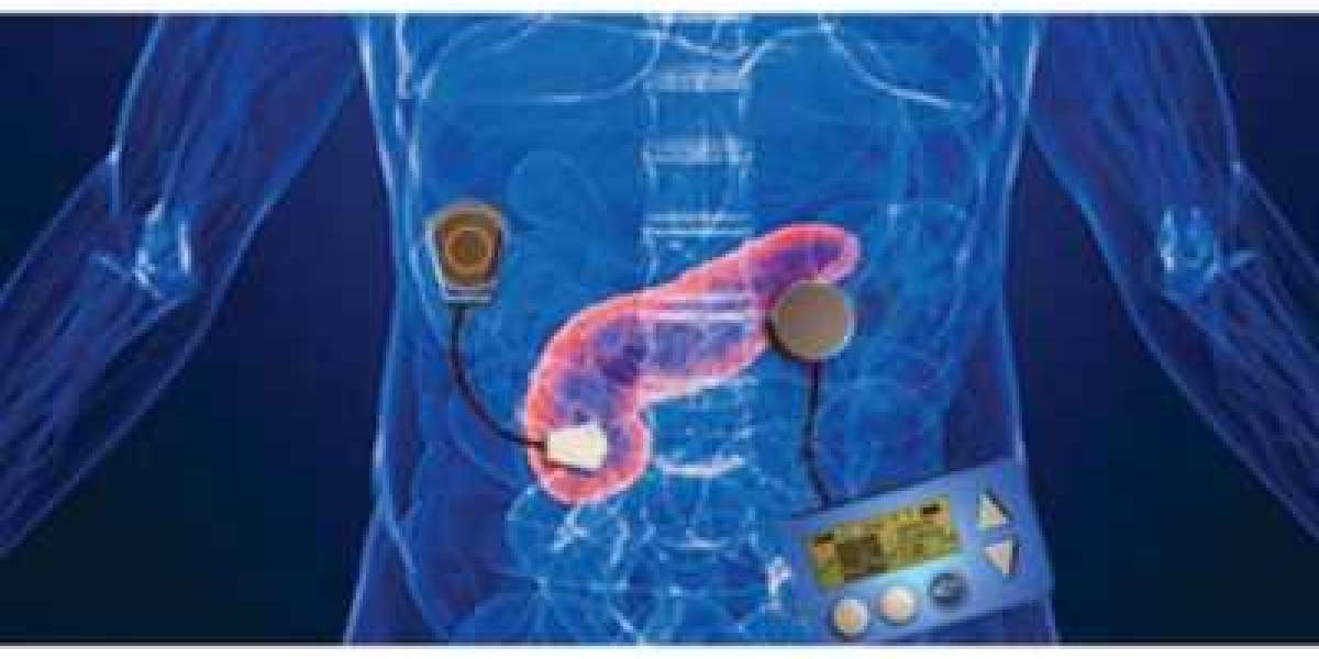 Artificial Pancreas Device System Market Worth $285.40 Million by 2032