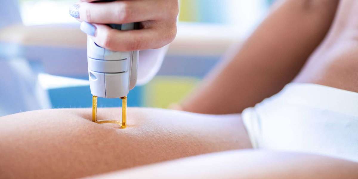 Innovative Treatments for Skin Tag Removal and Beyond