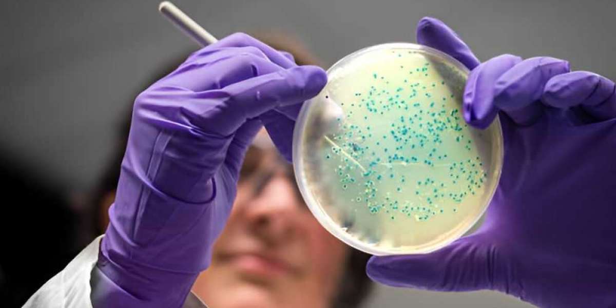Microbiology Analysis Market Statistics, Emerging Demands and Forecast to 2030