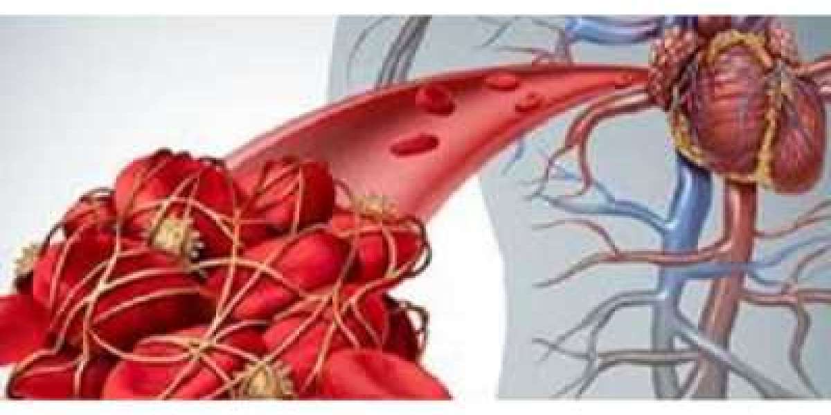 Platelet Aggregation Devices Market Worth $868.23 Million by 2032