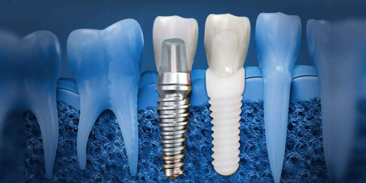 Zirconia in Dentistry Market Share, Trend, Segmentation and Forecast to 2031